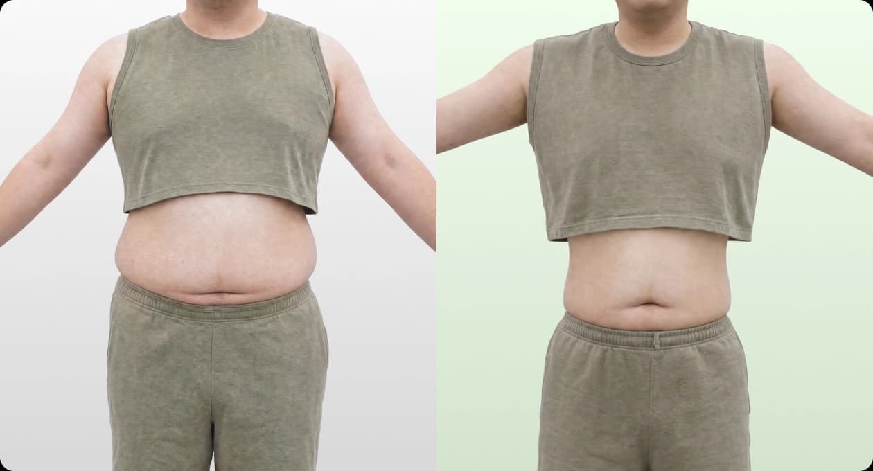 이** BEFORE · AFTER