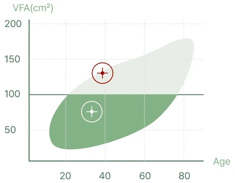나이별 내장지방 분포에서 감량 전 130.2cm², 감량 후 73.4cm² 위치